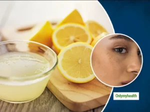 Wellhealthorganic.comEasily-Remove-Dark-Spots-Lemon-Juice Brighten Skin!