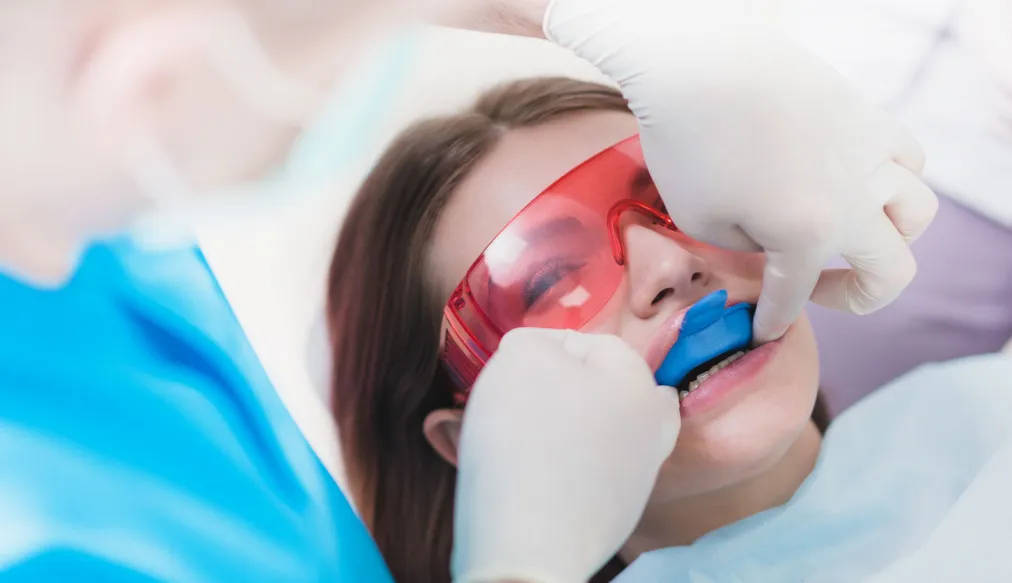 Prestige Dentistry Fluoride, Sealants, and Other Preventive Dental Care Explained.