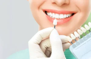 Top 6 Questions to Ask Before a London Veneer Treatment, Answered by a London Dentist