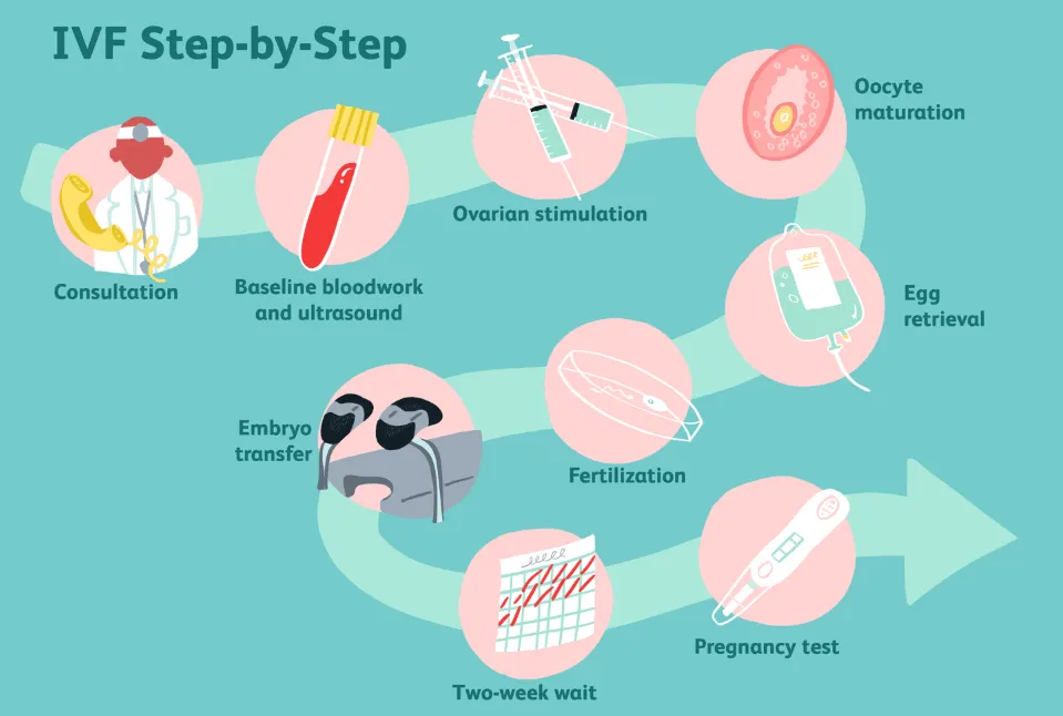 What are the Stages of IVF